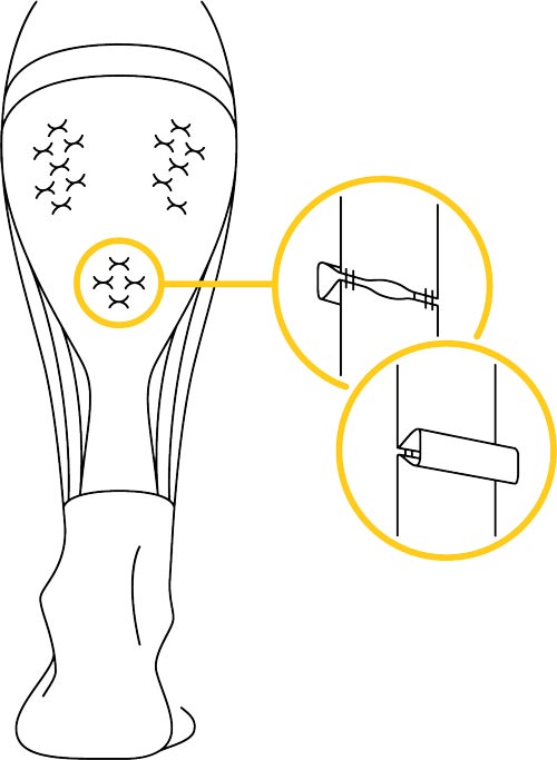 BestPerform Wade Kompressionsbandage mit Triggerpunktstimulation