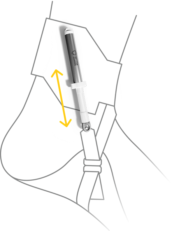 Malleo Adaptor