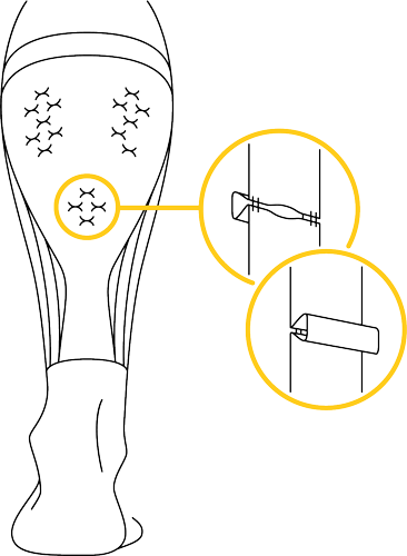 Triggerpunkte Compression Sleeves sportomedix